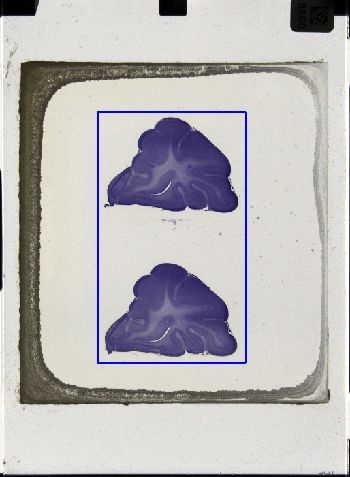 Media type: image; Special Collections 3043   shows specimen_part histological serial section;